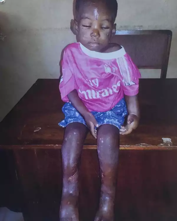 Amazing new photo of little girl tortured and accused of being a witch in Akure
